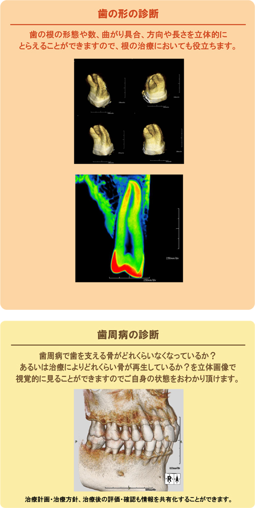 あなたの口腔内を3D画像で分析・診断 歯科用CTスキャナーのご案内 Finecube アーム型X線CT診断装置 ファインキューブ